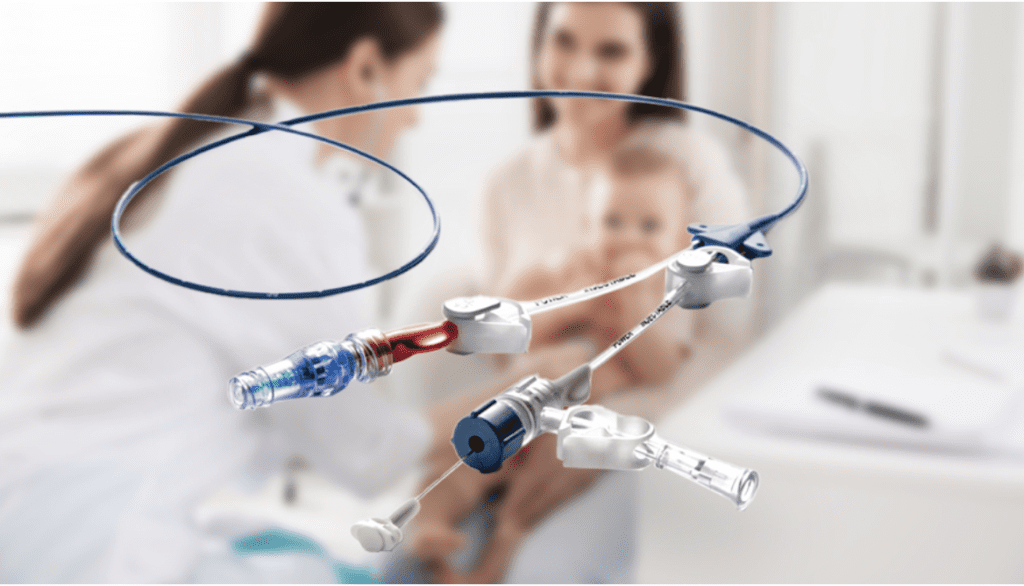Catheter Embolization